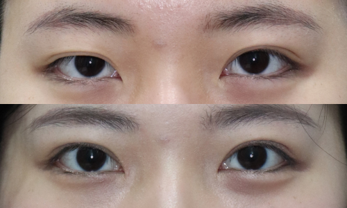 슬라이드35